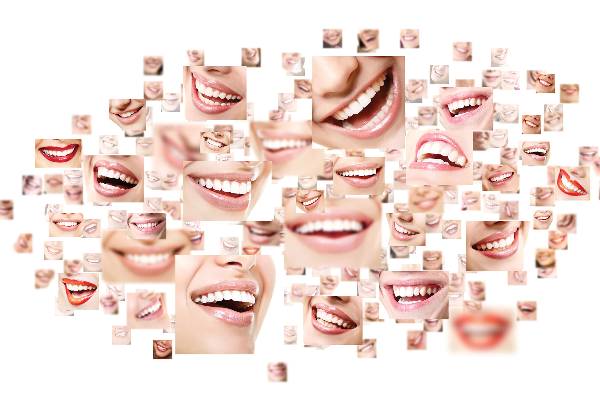 Smile Makeover